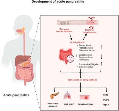 Exploring the gut microbiota’s crucial role in acute pancreatitis and the novel therapeutic potential of derived extracellular vesicles